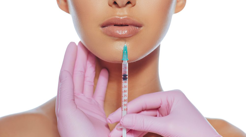 Cropped sensual female lips, procedure lip augmentation. Syringe near womans mouth, injections for increase lips shape